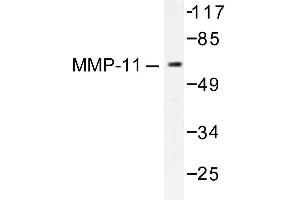 Image no. 1 for anti-Matrix Metallopeptidase 11 (Stromelysin 3) (MMP11) antibody (ABIN265523)