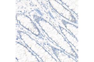 Immunohistochemistry of paraffin-embedded Human colon (negative control sample) using CD147/BSG antibody (ABIN7265838) at dilution of 1:100 (40x lens). (CD147 anticorps)