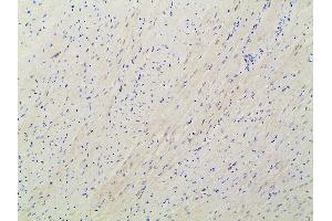 ABIN6277691 at 1/100 staining rat heart tissue sections by IHC-P. (Ephrin B2 anticorps  (C-Term))