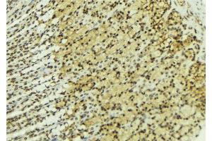 ABIN6277222 at 1/100 staining Human gastric tissue by IHC-P.