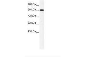 anti-Zinc Finger Protein 266 (ZNF266) (AA 27-76) antibody