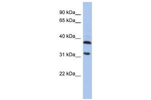 ASPA antibody used at 1 ug/ml to detect target protein. (ASPA anticorps)