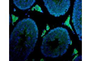 IF analysis of Cyp17a1 using anti-Cyp17a1 antibody (ABIN5693094).