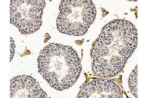 ABIN7095808 and ABIN7099870 at 1/100 staining mouse testis tissue by IHC-P.