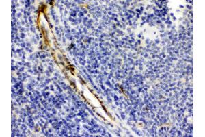 Alpha A Crystallin was detected in paraffin-embedded sections of mouse spleen tissues using rabbit anti- Alpha A Crystallin Antigen Affinity purified polyclonal antibody (Catalog # ) at 1 µg/mL.