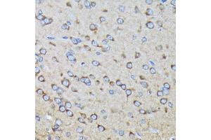 Immunohistochemistry of paraffin-embedded rat brain using R Rabbit mAb (ABIN7269840) at dilution of 1:100 (40x lens).