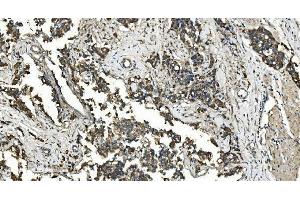 IHC analysis of FLCN using anti-FLCN antibody (ABIN7602491). (FLCN anticorps  (AA 8-551))