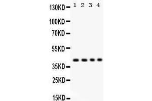 Western Blotting (WB) image for anti-Parvin, alpha (PARVA) (AA 155-185), (Middle Region) antibody (ABIN3043590)