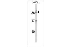 Western blot analysis of KLK12 / Kallikrein-12 Antibody (Center) in WiDr cell line lysates (35ug/lane). (Kallikrein 12 anticorps  (Middle Region))