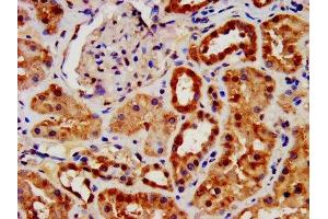 IHC image of ABIN7144472 diluted at 1:1400 and staining in paraffin-embedded human kidney tissue performed on a Leica BondTM system.