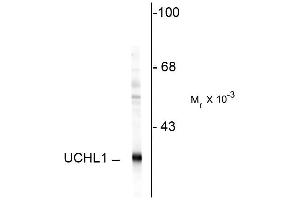 Western blot of rat hippocampal homogenate showing specific immunolabeling of the ~ 24k UCHL1 protein. (UCHL1 anticorps)