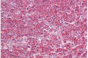 Anti-LY86 / MD-1 antibody IHC staining of human spleen.