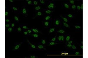 Immunofluorescence of monoclonal antibody to SMAD5 on HeLa cell. (SMAD5 anticorps  (AA 105-182))