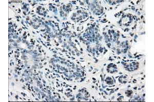 Immunohistochemical staining of paraffin-embedded breast tissue using anti-IDH1 mouse monoclonal antibody. (IDH1 anticorps)