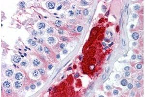 Human Testis: Formalin-Fixed, Paraffin-Embedded (FFPE)