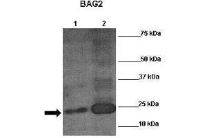 Lanes: Human placenta Primary Antibody Dilution: 1:200Secondary Antibody: Anti-rabbit-HRP Secondary Antibody Dilution: 1:0000  Gene Name: Brown: EPAS1 Purple: Haemotoxylin Submitted by: EPAS1