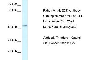 Western Blotting (WB) image for anti-Mitochondrial Trans-2-Enoyl-CoA Reductase (MECR) (C-Term) antibody (ABIN2788923) (MECR anticorps  (C-Term))