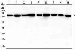 Western blot analysis of MSN using anti-MSN antibody (ABIN7600378). (Moesin anticorps  (AA 184-568))