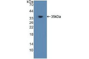 Western blot analysis of recombinant Human TRAF6. (TRAF6 anticorps  (AA 153-423))