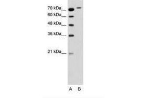 Image no. 2 for anti-rho-Related BTB Domain Containing 1 (RHOBTB1) (C-Term) antibody (ABIN6736347)