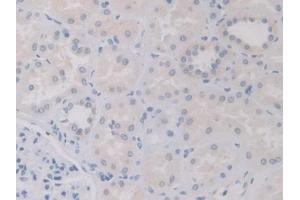 Detection of IL12A in Human Kidney Tissue using Polyclonal Antibody to Interleukin 12A (IL12A)