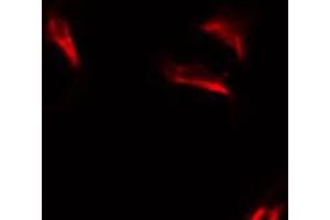 ABIN6274633 staining HuvEc by IF/ICC.