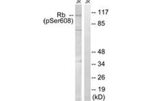 Western blot analysis of extracts from Jurkat cells treated with PMA 125ng/ml 30', using Retinoblastoma (Phospho-Ser608) Antibody. (Retinoblastoma Protein (Rb) anticorps  (pSer608))