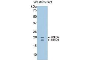 Detection of recombinant CD40L using Polyclonal Antibody to Cluster Of Differentiation 40 Ligand (CD40L) (CD40 Ligand anticorps  (AA 111-261))