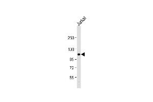 Anti-PI3CKG Antibody (C-term) at 1:1000 dilution + Jurkat whole cell lysate Lysates/proteins at 20 μg per lane.