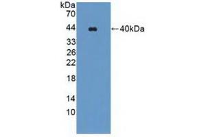 Detection of Recombinant WNK1, Human using Polyclonal Antibody to WNK Lysine Deficient Protein Kinase 1 (WNK1) (WNK1 anticorps  (AA 1954-2231))