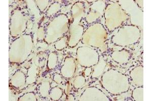 Immunohistochemistry of paraffin-embedded human thyroid tissue using ABIN7147407 at dilution of 1:100