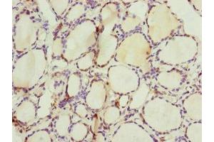 Immunohistochemistry of paraffin-embedded human thyroid tissue using ABIN7147407 at dilution of 1:100 (CEP44 anticorps  (AA 1-280))