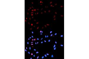 Immunofluorescence analysis of U2OS cells using Phospho-H2AFX-S139 antibody (ABIN5969940). (H2AFX anticorps  (pSer139))