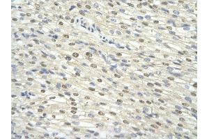 Rabbit Anti-GTF2H3 antibody Catalog Number: ARP31438  Paraffin Embedded Tissue: Human Heart  cell Cellular Data: cardiac cell  Antibody Concentration: 4.
