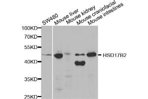 Western blot analysis of extracts of various cell lines, using HSD17B2 antibody. (HSD17B2 anticorps)
