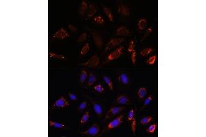 Immunofluorescence analysis of U-2 OS cells using MRPL23 antibody (ABIN7268564) at dilution of 1:100.
