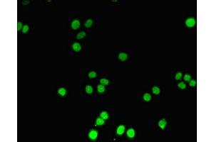 Immunofluorescent analysis of PC-3 cells using ABIN7150213 at dilution of 1:100 and Alexa Fluor 488-congugated AffiniPure Goat Anti-Rabbit IgG(H+L) (TdT anticorps  (AA 1-509))