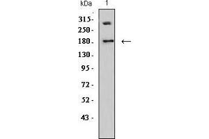 Western blot analysis using DNMT1 mouse mAb against Jurkat (1) cell lysate.