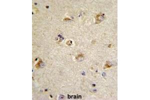 Immunohistochemistry (IHC) image for anti-Cell Division Cycle Associated 3 (CDCA3) antibody (ABIN3002713)