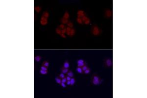 Immunofluorescence analysis of MCF7 cells using MonoMethyl-Histone H3-K27 Rabbit pAb (ABIN3023262, ABIN3023263, ABIN3023264, ABIN1513004 and ABIN6219518) at dilution of 1:50 (40x lens). (Histone 3 anticorps  (H3K27me1))