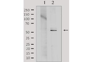 Western blot analysis of extracts from Hela, using TINF2 Antibody. (TINF2 anticorps  (Internal Region))