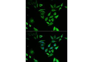 Immunofluorescence analysis of U2OS cell using NUTF2 antibody. (NUTF2 anticorps)