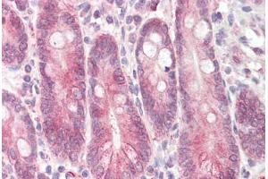 Image no. 2 for anti-Signal Transducing Adaptor Family Member 2 (STAP2) (AA 437-449) antibody (ABIN1492826) (STAP2 anticorps  (AA 437-449))