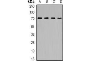 Western blot analysis of CNDP1 expression in A431 (A), HepG2 (B), mouse kidney (C), rat brain (D) whole cell lysates.
