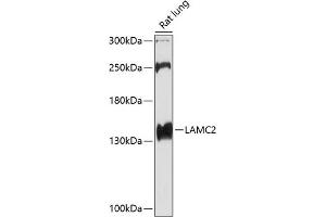 Western blot analysis of extracts of rat lung, using L antibody (ABIN6128174, ABIN6143076, ABIN6143077 and ABIN6219002) at 1:1000 dilution. (LAMC2 anticorps  (AA 862-1111))