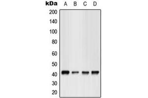 Western blot analysis of GPR17 expression in HEK293T (A), Jurkat (B), NIH3T3 (C), rat kidney (D) whole cell lysates. (GPR17 anticorps  (Center))