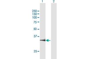 Western Blot analysis of PARP16 expression in transfected 293T cell line by PARP16 MaxPab polyclonal antibody. (PARP16 anticorps  (AA 1-323))