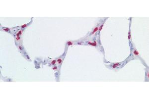 Detection of LAMP3 in Human Lung Tissue using Polyclonal Antibody to Lysosomal Associated Membrane Protein 3 (LAMP3)