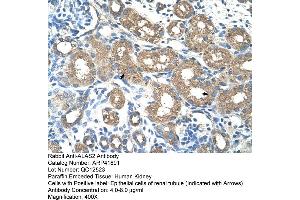 Rabbit Anti-ALAS2 Antibody  Paraffin Embedded Tissue: Human Kidney Cellular Data: Epithelial cells of renal tubule Antibody Concentration: 4. (ALAS2 anticorps  (N-Term))