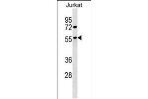 Western blot analysis in Jurkat cell line lysates (35ug/lane). (GPRC5B anticorps  (C-Term))